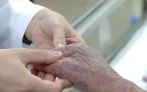 Tăng nặng bệnh viêm da cơ địa trong mùa lạnh