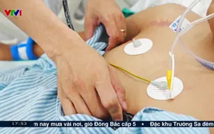 Nhiều người trẻ ngộ độc thuốc lá điện tử