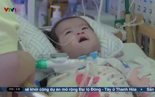 Hàn Quốc: Cứu sống trẻ sơ sinh tim nằm ngoài lồng ngực
