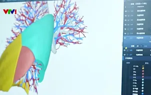 A.I. - "Cánh tay phải" đắc lực của bác sĩ”