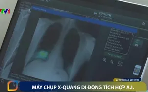 Máy chụp X-quang di động tích hợp A.I.
