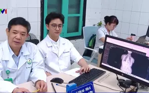 Khám gù vẹo cột sống miễn phí