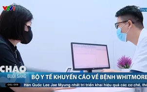 Bộ Y tế khuyến cáo về bệnh Whitmore