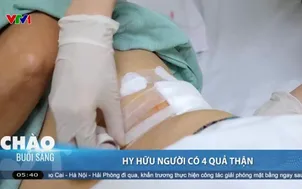 Người phụ nữ mang 4 quả thận suốt nhiều năm