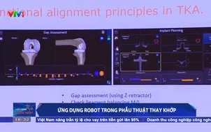 Ứng dụng robot trong phẫu thuật thay khớp