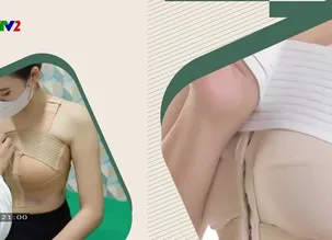 Khỏe đẹp cho ngày mới: Tư vấn về phẫu thuật vòng 1