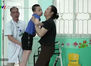 Sống khỏe mỗi ngày: Châm cứu điều trị di chứng bại não