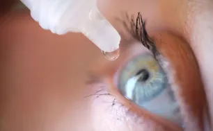 Cảnh báo đục thủy tinh thể thứ phát do tự ý dùng thuốc nhỏ mắt chứa corticoid