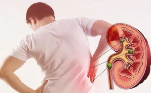 Cảnh báo rủi ro nghiêm trọng đối với sức khỏe xuất phát từ các vấn đề về thận