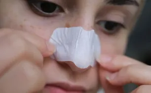 3 bước đơn giản giúp thu nhỏ lỗ chân lông