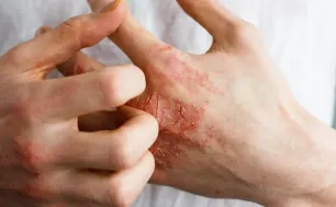 Câu chuyện về nỗi ám ảnh "nửa sống nửa chết" vì loại thuốc hàng triệu người tin dùng