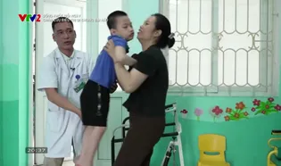 Sống khỏe mỗi ngày: Châm cứu điều trị di chứng bại não