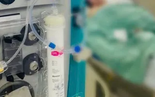 Thay huyết tương cứu sống bệnh nhân suy gan cấp
