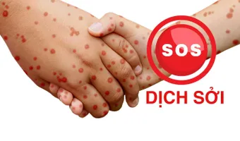 SOS - Dịch sởi