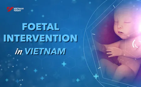 Foetal Intervention in Vietnam | Health Matters