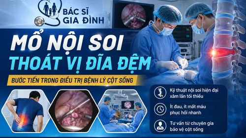 Bác sĩ gia đình: Mổ nội soi thoát vị đĩa đệm