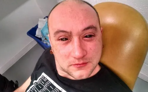 Thử nghiệm thành công hóa chất giúp mắt người tinh như mắt mèo