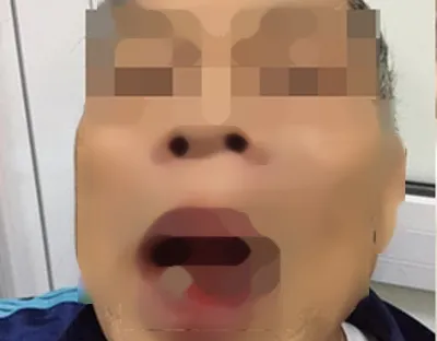 Cách chức cán bộ Sở Ngoại vụ hành hung người già