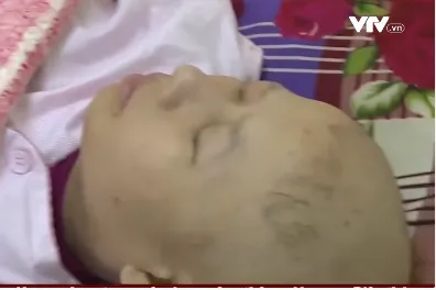 Gia tăng tình trạng ung thư ở giới trẻ