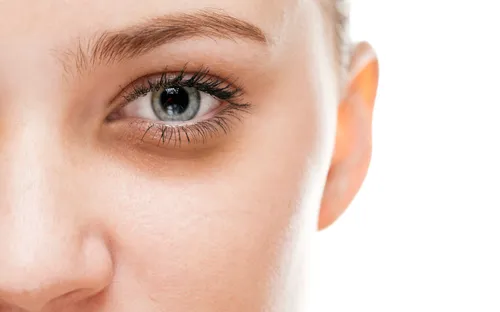 Lý do khiến mắt trông mệt mỏi ngay cả khi ngủ đủ giấc