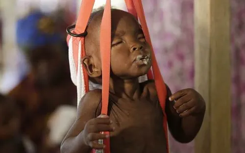 Hàng triệu trẻ em Sudan nguy cơ suy dinh dưỡng do thiếu nước sạch