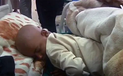 Yemen: 2/3 số ca ung thư không được phát hiện trong năm 2017