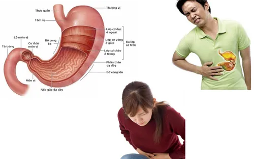 Khoẻ Vui "Bệnh viêm bao tử" (20h55 thứ bảy, 21/4)