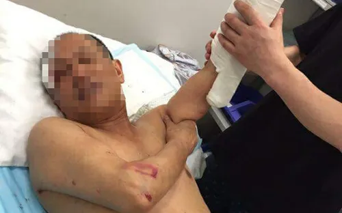 Nha Trang: Làm rõ vụ nhân viên nhà hàng và khách du lịch ẩu đả trước ngày 20/5