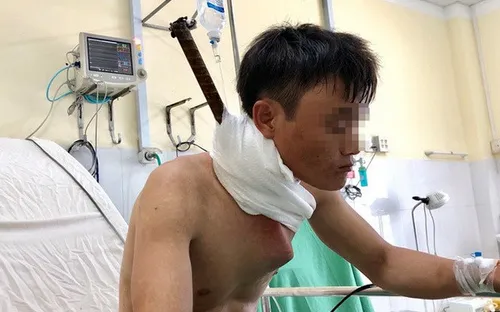 Khánh Hòa: Cứu sống bệnh nhân bị cây sắt đâm xuyên cổ xuống ngực