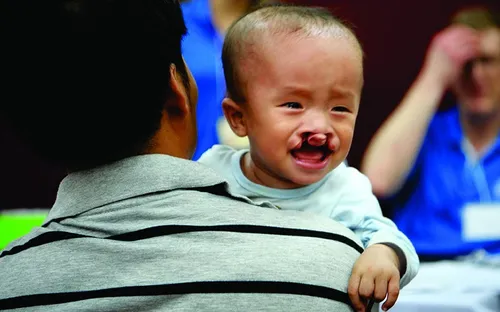 Đà Nẵng: Gần 100 trẻ em nghèo được khám sàng lọc qua chương trình "Nụ cười nhân ái"