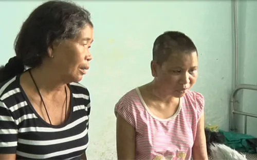 Bộ LĐTBXH yêu cầu xử lý nghiêm vụ chủ nhà tra tấn, đánh đập dã man người làm công tại Gia Lai