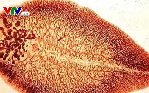 Tư vấn sức khỏe "Sán lá gan – Mối nguy không nhỏ"  (9h15 Chủ nhật, 29/7) trên VTV8