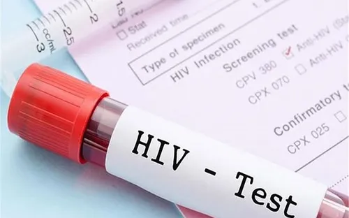 Thử nghiệm thành công giai đoạn đầu vaccine mới phòng HIV/AIDS