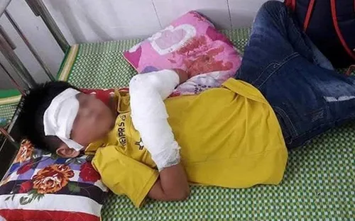 Công an vào cuộc vụ điện thoại làm nổ cháu bé nát tay