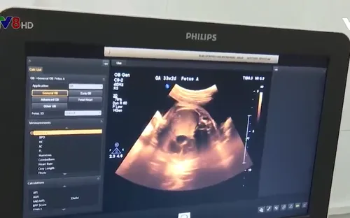 Đà Nẵng nâng cao chất lượng dân số