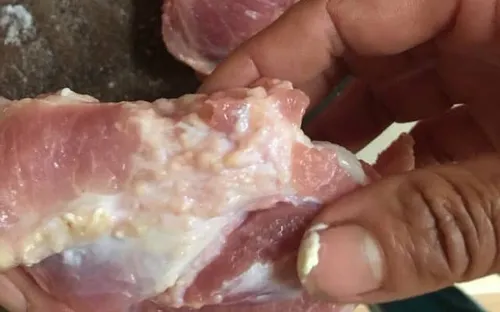 Cách phòng ngừa bệnh sán lợn ở người