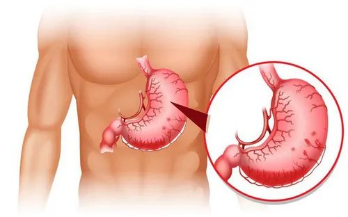 Để có dạ dày khỏe mạnh