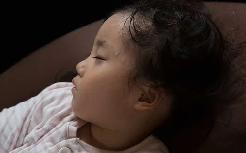 Một số phương pháp xử lý mồ hôi trộm cho trẻ