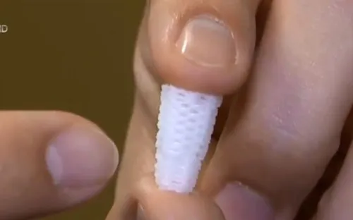 Tiết kiệm thời gian và chi phí điều trị bằng chân răng 3D