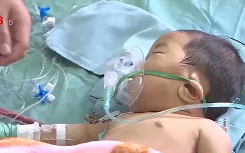 Làm chủ kỹ thuật mổ tim qua đường nách cho bệnh nhi