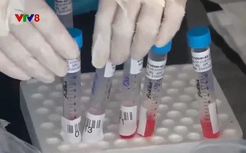 Bộ Y tế nghiên cứu xây dựng quy trình xét nghiệm nhóm Covid-19