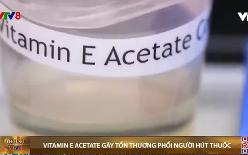 Mối liên quan giữa vitamin E Acetate với bệnh tổn thương phổi