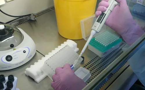 Nga phát hiện một bệnh nhân mang... 18 biến thể SARS-CoV-2