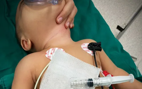 Đang ăn dặm thì quấy khóc liên tục, vào viện bác sĩ tìm ra thủ phạm ít ai ngờ