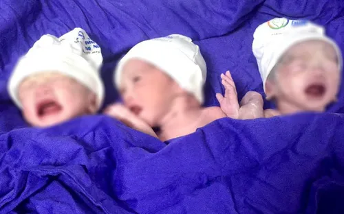 Mổ bắt con cho sản phụ mang tam thai 2 gái, 1 trai