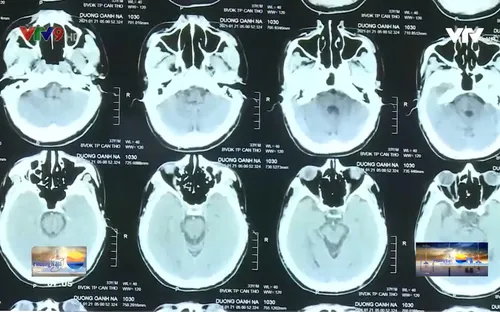 Tác hại nghiêm trọng của ngộ độc rượu