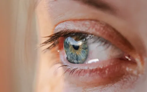 Tình trạng hiếm gặp khiến người phụ nữ "khóc ra máu"