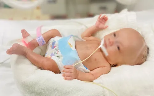 Sau 10 năm nghiên cứu, trau dồi, các bác sĩ Bệnh viện Phụ sản Trung ương lập kỳ tích cứu sống bé sinh non nặng vỏn vẹn 400 gram