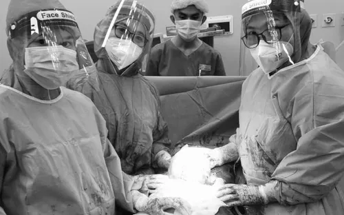 Phẫu thuật lấy thai, bảo tồn tử cung cho sản phụ có khối u xơ tử cung kích thước lớn