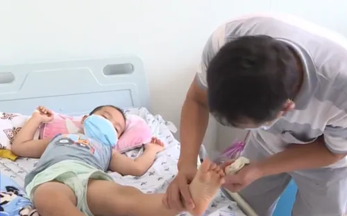 Nhiều phụ huynh nhầm lẫn bệnh tay chân miệng với viêm họng sổ mũi